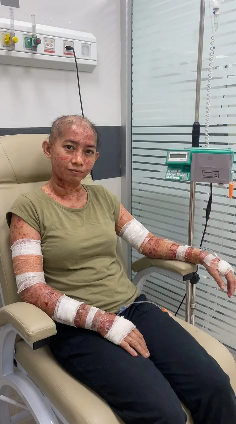 Luana guardou uma mecha de cabelo antes de raspar tudo durante a quimioterapia